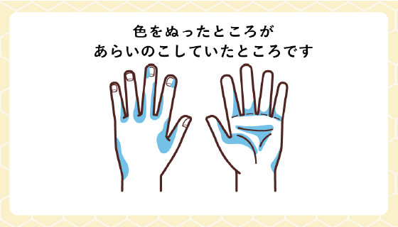 間違いクイズ