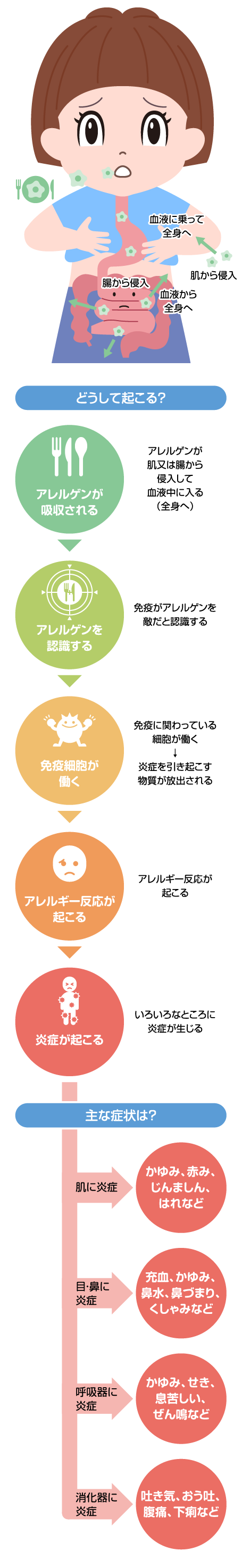 食物アレルギーが起こる主な仕組み・アレルゲン・症状2